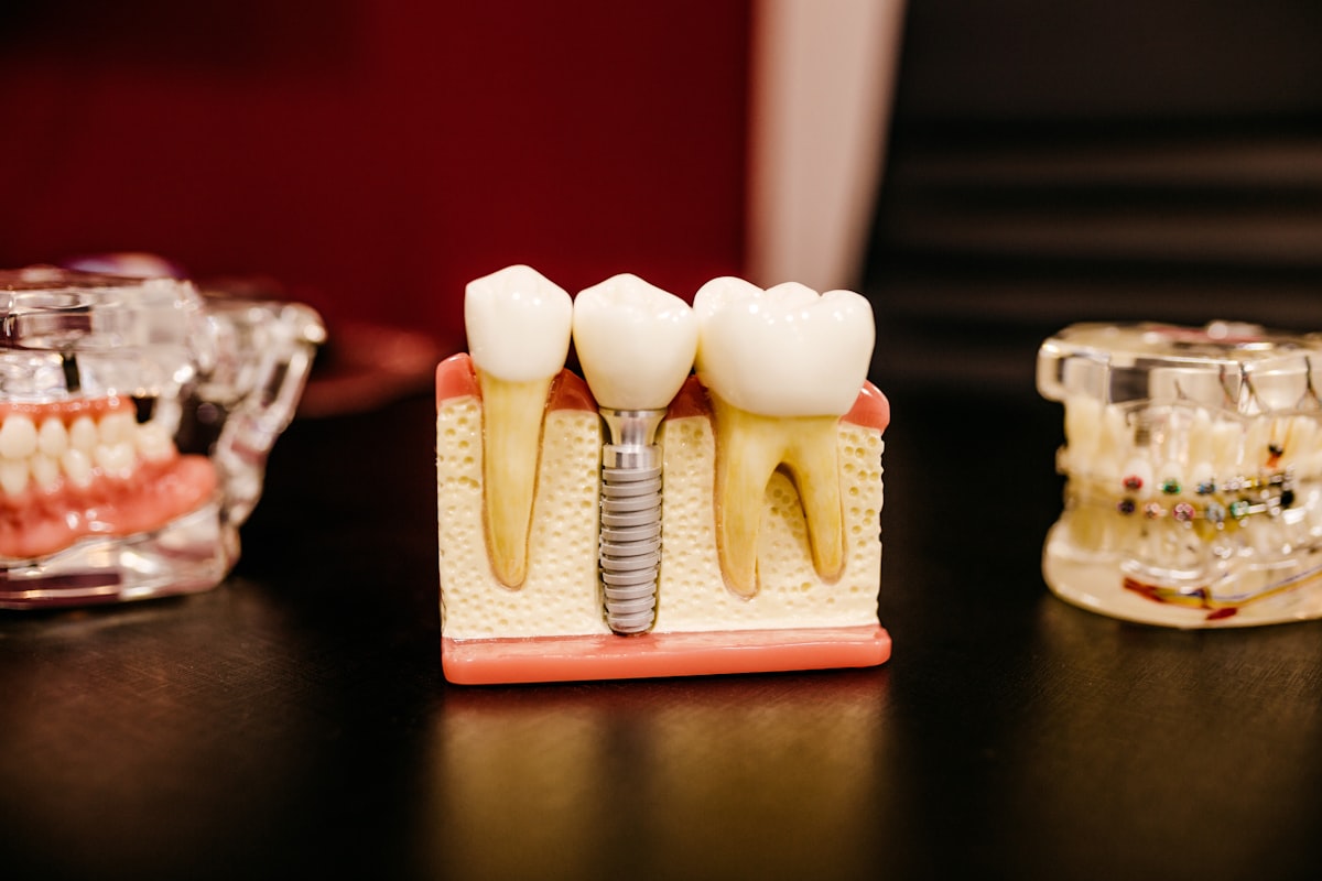 Dental implant and teeth model used to explain treatment options